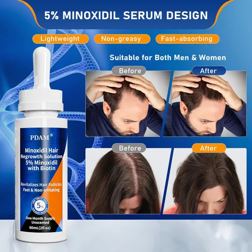 Vista 5 de Kit de crecimiento de cabello y barba de 5% minoxidil para hombres, suero de crecimiento del cabello para mujeres, tratamiento de pérdida de cabello