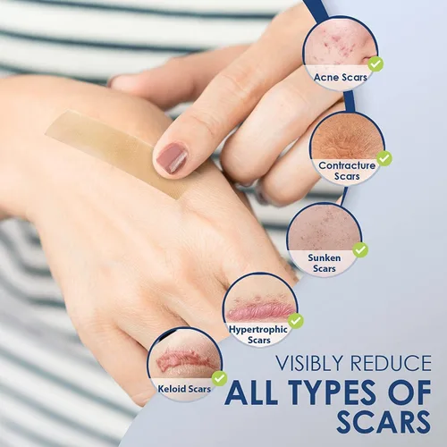 Vista 4 de Hojas de silicona para la eliminación de cicatrices quirúrgicas: cinta reutilizable para tratamiento de cicatrices queloides, cesáreas