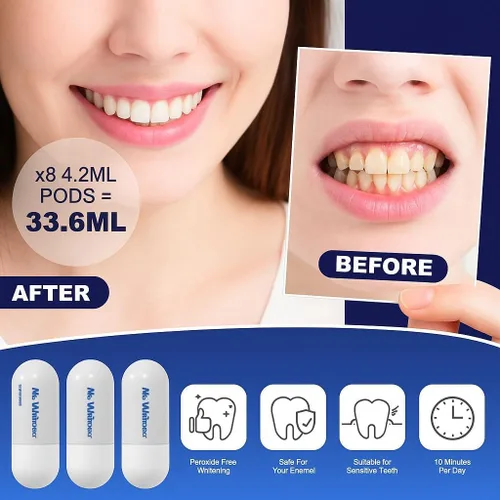 Vista 3 de Kit de blanqueamiento dental Luz LED para dientes sensibles, recomendado por dentistas, esmalte seguro, blanqueador profesional de dientes