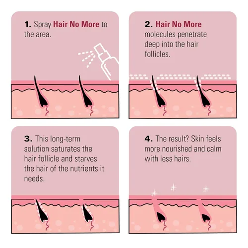 Vista 4 de Skin Doctors Hair No More Inhibidor Spray 4.1 fl oz