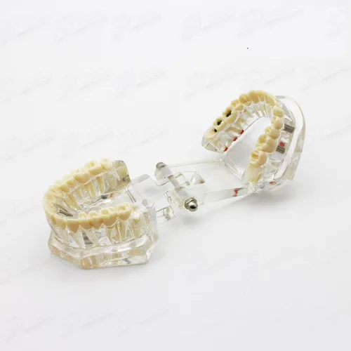 Vista 6 de Modelo de dientes dentales, modelo de dientes de implantes dentales transparentes Dentista Enfermedad estándar Diente extraíble Modelo de enseñanza