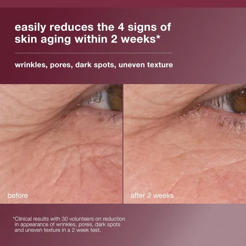 Vista 5 de Dermalogica Dynamic Skin Retinol Facial Serum with Multi-Retinoid Complex, Skin Retexturizing and Improving Skin Health