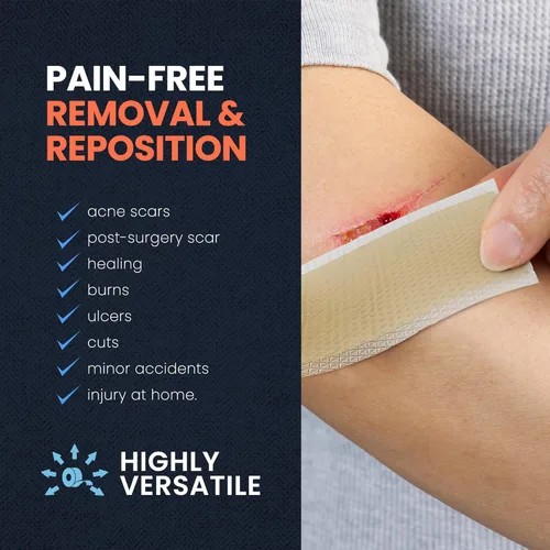 Vista 4 de MED PRIDE Rollo de cinta de silicona de grado médico para heridas y cicatrices, 1.5 pulgadas x 1.6 yardas, extracción sin dolor, fácil de rasgar
