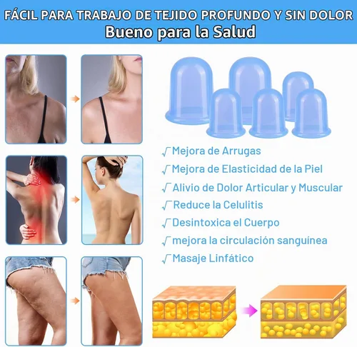 Vista 3 de Juego de terapia de ventosas de silicona (6 piezas), kit de ventosas para terapia de masaje Azul transparente