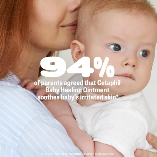 Vista 7 de Cetaphil - Ungüento curativo para bebé, ungüento para el sarpullido del pañal que calma y protege la piel irritada del bebé, protector de la piel
