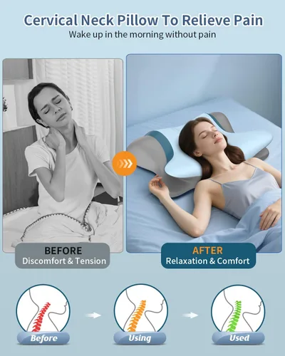 Vista 8 de Almohada cervical cervical para aliviar el dolor, almohada ergonómica para dormir de lado para apoyar el cuello, almohadas ortopédicas de espuma