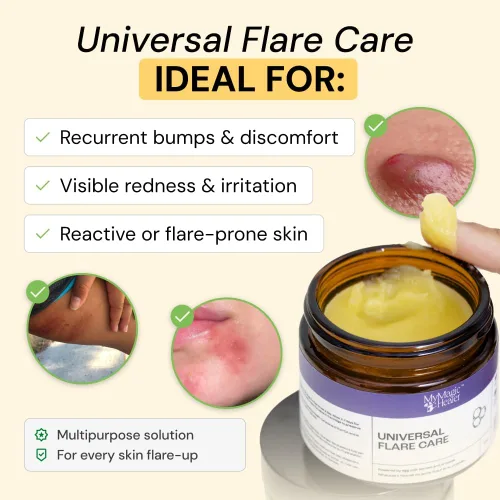 Vista 2 de MyMagicHealer Universal Flare Care Pomada Extractora para HS, forúnculos, quistes, hemorroides, quiste pilonidal, absceso Anti-rozaduras