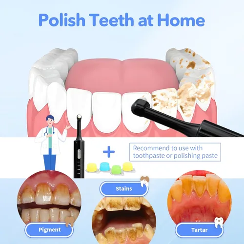 Vista 5 de Pulidor de dientes eléctrico, removedor de placa para blanquear los dientes, kits de pulido de dientes 4 modos de velocidad, pulidor dental