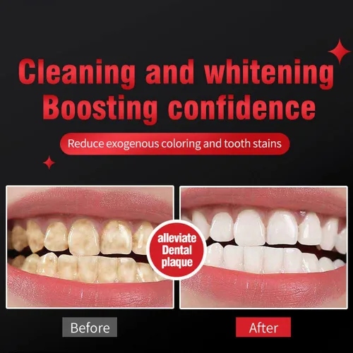 Vista 6 de SP-6 Pasta dental blanqueadora probiótica – Fórmula avanzada con 6 probióticos para blanquear los dientes y la salud de las encías, sin flúor