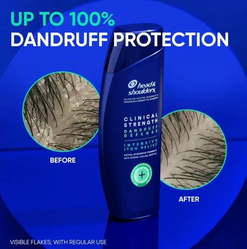 Vista 6 de Head & Shoulders Clinical Strength Dandruff Defense - Champú 2 en 1 + acondicionador, champú para aliviar la picazón, control de escamas, cuidado