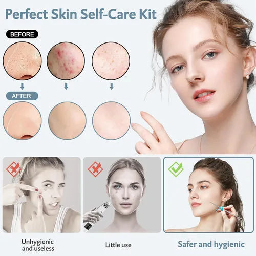 Vista 2 de MENOLY Kit de herramientas para reventar espinillas, 10 piezas, herramienta para eliminar espinillas, para acné, espinillas, comedones, acné, nariz