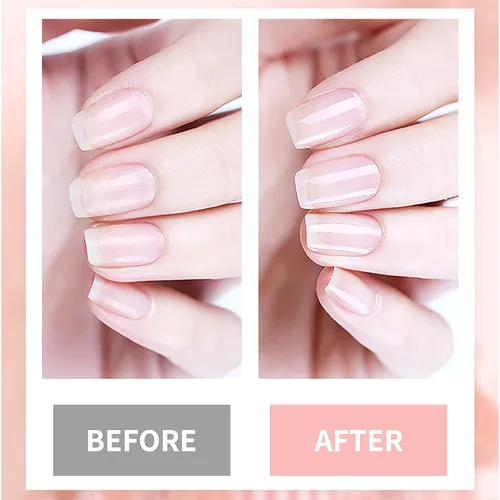 Vista 3 de Endurecedor de uñas 4 en 1, fortalecedor de uñas, rescate de uñas, imprimación de calcio para uñas finas, crecimiento, reparación de uñas, kit