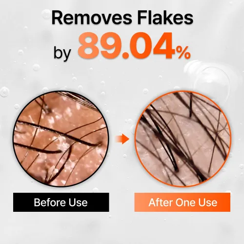 Vista 5 de lilyeve GROWTURN - Suero de crecimiento del cabello con cepillo integrado, exosomas derivados de hojas de corazón para revitalizar el cabello