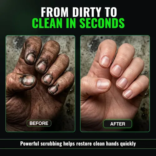 Vista 8 de Grip Clean Cepillo de uñas resistente para limpiar las uñas - Cepillo de limpieza de uñas para hombres y mujeres Cepillo mecánico. Limpiador