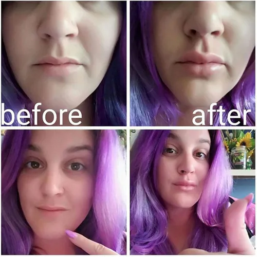Vista 4 de Dispositivo de relleno de labios Refuerzo de labios de silicona suave con forma de pez, boca más gruesa más completa, bombas de labios
