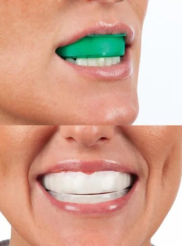 Vista 9 de Opalescence Go - Bandejas blanqueadoras de dientes precargadas - Original 15% - (4 tratamientos) - Peróxido de hidrógeno con PF - Menta fresca