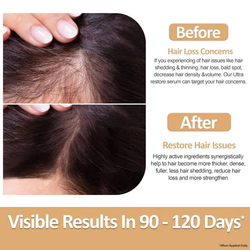 Vista 8 de Ultra Restore - Suero para el crecimiento del cabello - Promueve el crecimiento más completo del cabello y reduce la pérdida de cabello, nutre