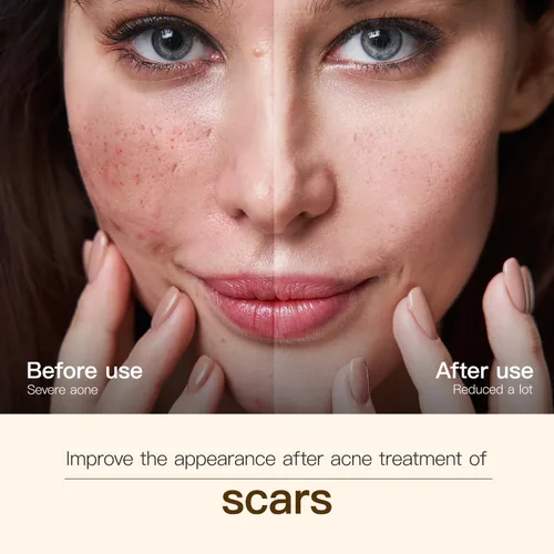 Vista 3 de Madagascar Centella, suero facial para cara, extracción natural de bakuchiol, extracto de centella asiática para calmar la piel sensible y propensa