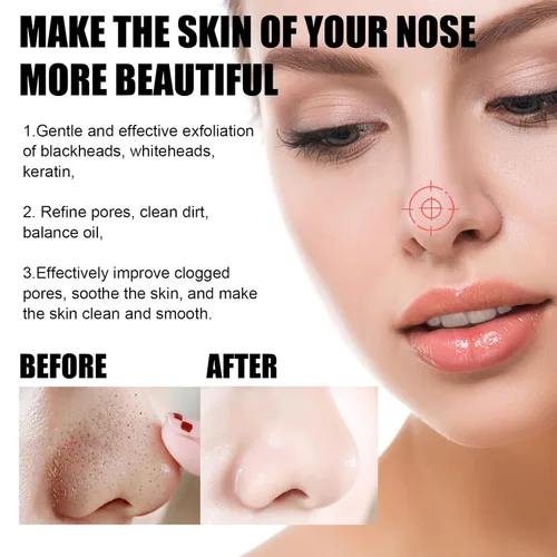 Vista 3 de Pro-Herbal - Máscara facial de refinación despegable, mascarilla de refinación a base de hierbas, máscara de limpieza de puntos negros, máscara