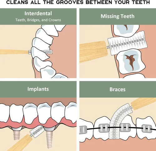 Vista 3 de Isshah Cepillos interdentales de bambú, limpiador entre dientes, cepillo de limpieza profunda, 40 unidades, tamaño 0, pequeños huecos