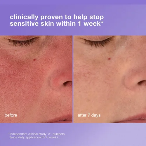 Vista 3 de Dermalogica Stabilizing Repair Cream, Face Moisturizer for Sensitive Skin with Cica - Strengthens, Soothes, and Repairs Skin Barrier