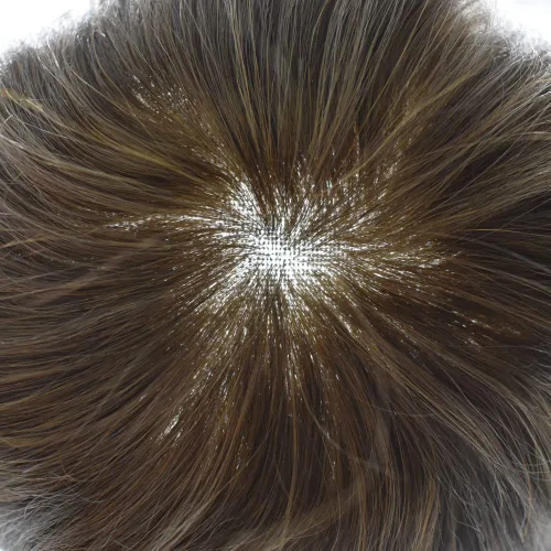 Vista 304 de Toupee - Sistemas de reemplazo de cabello para hombre, encaje frontal suizo, nudo blanqueado, pieza de cabello humano natural