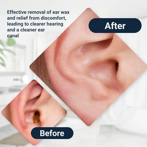 Vista 6 de Elephant Ear Washer Bottle System by Doctor Easy