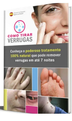 Como Eliminar Verrugas em 7 dias ! Dê Adeus as Verrugas (Portuguese Edition) Edición Kindle