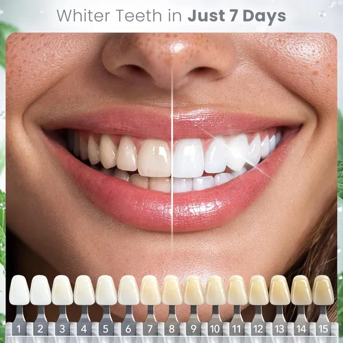 Vista 3 de Tiras blanqueadoras suaves para dientes – (40 tiras) blanqueamiento de dientes libres de peróxido para una sonrisa radiante – Blanqueamiento dental