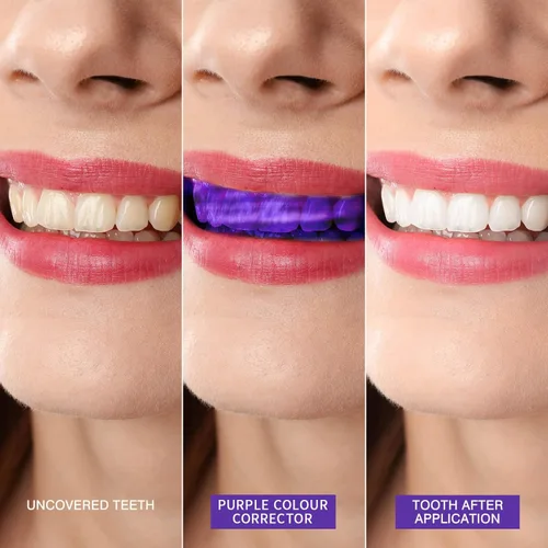 Vista 4 de Potenciador de blanqueamiento dental instantáneo, pasta de dientes morada para blanquear los dientes, pasta dental morada, eliminación de manchas