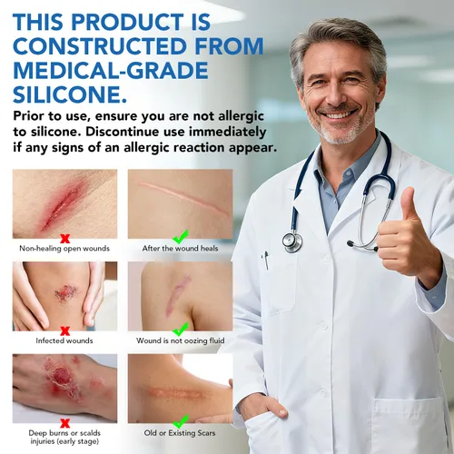 Vista 7 de Hojas de silicona para cicatrices, cinta adhesiva de silicona (rollo de 1.6 x 60 pulgadas - 4.9 ft), cinta adhesiva reutilizable, suave y de grado