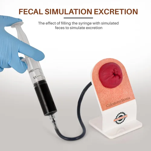 Vista 4 de Kit de entrenamiento para el cuidado de la ostomía, modelos de estoma para educación médica, kit de modelo de práctica de ostomía para demostración