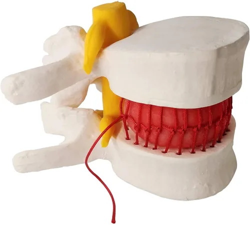 Vista 6 de EVOTECH SCIENTIFIC Modelo de disco hernia humana, hernia anatómica de vértebras lumbares modelo de prolapso de disco para enseñanza médica