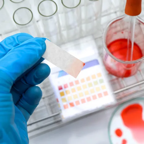 Vista 2 de TEHAUX 500 tiras de papel de cromatografía de grado 1, papel de filtro de laboratorio rectangular de 3 x 1 pulgadas para separación de pigmentos