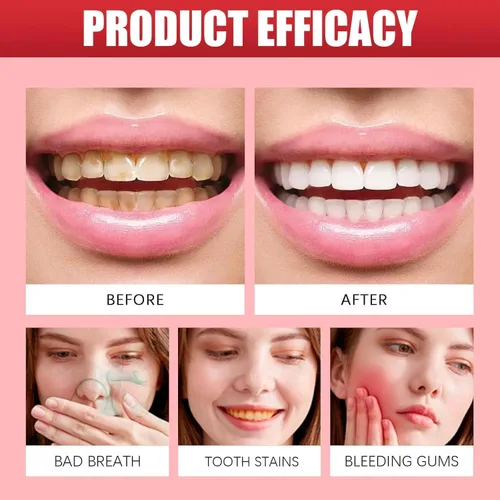 Vista 5 de SP10 Pasta de dientes probiótica, SP 10 pasta de dientes probiótica blanqueadora, fórmula de aliento fresco con probióticos, limpieza profunda