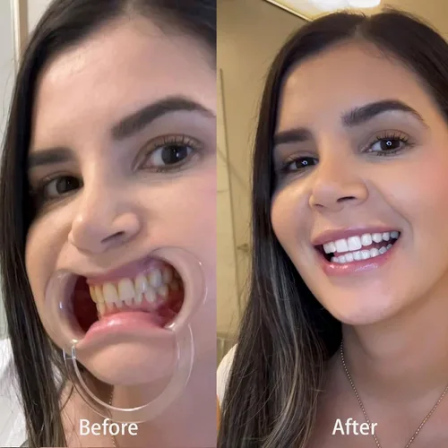 Vista 2 de Potenciador de blanqueamiento dental instantáneo, pasta de dientes morada para blanquear los dientes, pasta dental morada, eliminación de manchas