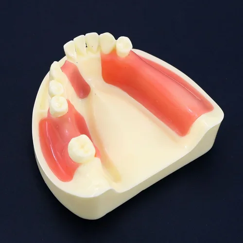 Vista 12 de Multifarious Tipos Modelo Dental Dientes Removibles Implante Ortodoncia Enseñanza Estudiar Modelos de demostración para Dentista Estudiante Escuela