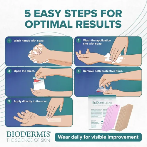 Vista 8 de Epiderm - Tiras de silicona para cicatrices, cinta de silicona de alta calidad para un cuidado óptimo de las cicatrices, versátil, flexible