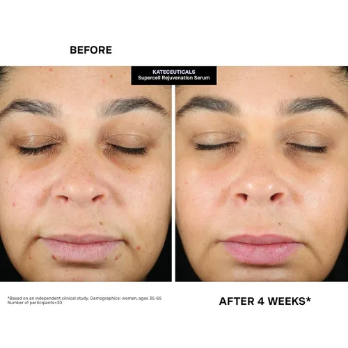 Vista 11 de Kate Somerville KateCeuticals® SuperCell - Suero peptídico de rejuvenecimiento para reparar la piel dañada y reducir líneas finas y arrugas, 1 onza
